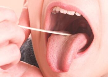 Crecen los casos invasivos por estreptococo: cuáles son los síntomas