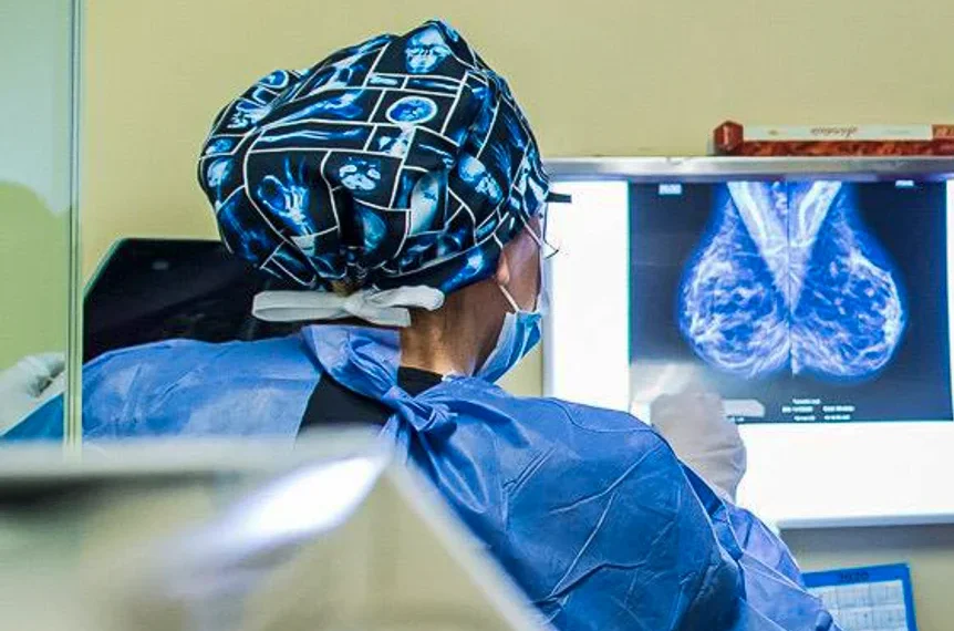 Un test de saliva que detecta el cáncer de mama en 5 segundos