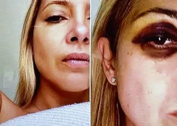 Difundieron fotos de Fabiola Yáñez golpeada y chats reveladores