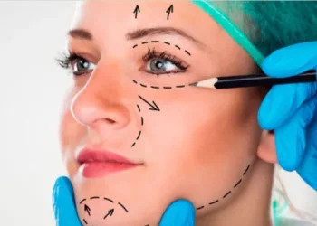 Afirman que creció «muchísimo» la cantidad de mujeres que cada vez más jóvenes se someten a cirugías faciales
