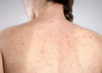 “¡Vacuná a tu hijo, ya!”: el desesperado ruego del Ministro de Salud