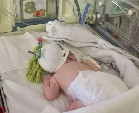 Bronquiolitis: en el pico del invierno, la internación pediátrica superó el 90% de las camas hospitalarias