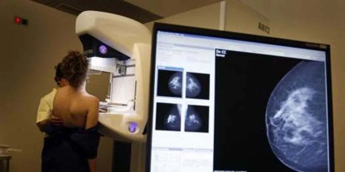 Cáncer de mama: cada año se diagnostica a unas 22.000 personas