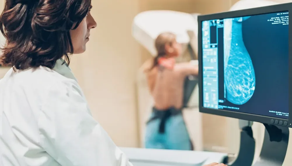 Cáncer de mama: en Argentina se registran más de 20 mil nuevos casos al año