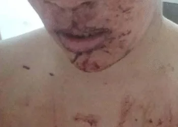 Cuatro mujeres golpearon a otra a la salida de un boliche