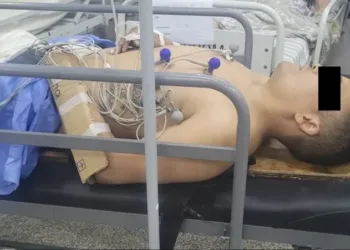 Mar del Plata: pareja de mujer policía le fracturó los dos brazos al ladrón que intentó agredirla