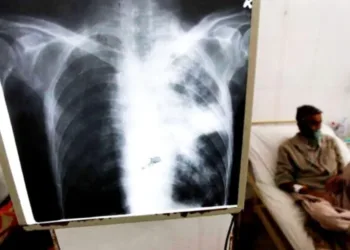 Mar del Plata: detectaron un caso de tuberculosis en un colegio y activaron el protocolo sanitario